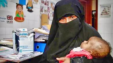اليمن بـ«يوم الأغذية العالمي».. كفاح ضد شبح الجوع